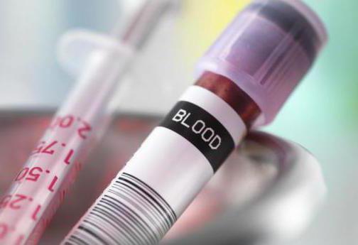 Leukocitų atpažinimas analizuojant kraują. Paaiškinimas